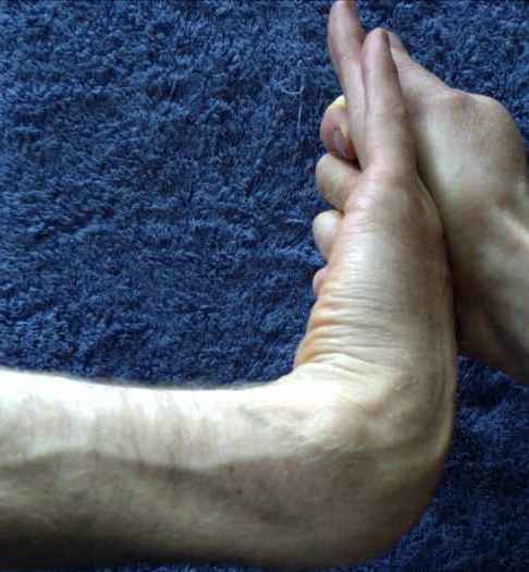 Wrist and forearm : adducting twist