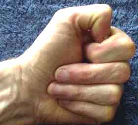 Thumb : second knuckle : forward fold